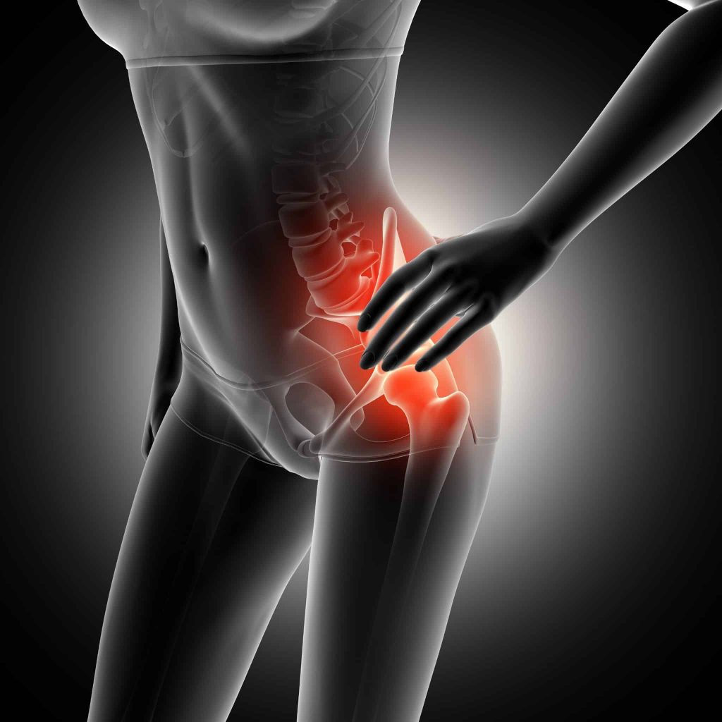 A medical illustration of a woman's lower torso with a highlighted red area around the hip joint, indicating pain or inflammation in the hip region. The hand rests near the affected area, suggesting possible groin muscle strain.