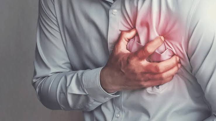 A person in a white shirt clutches their chest in pain, with a red area highlighting discomfort—possibly indicating symptoms of chest pain or a heart attack, which can sometimes be caused by conditions like Costochondritis.