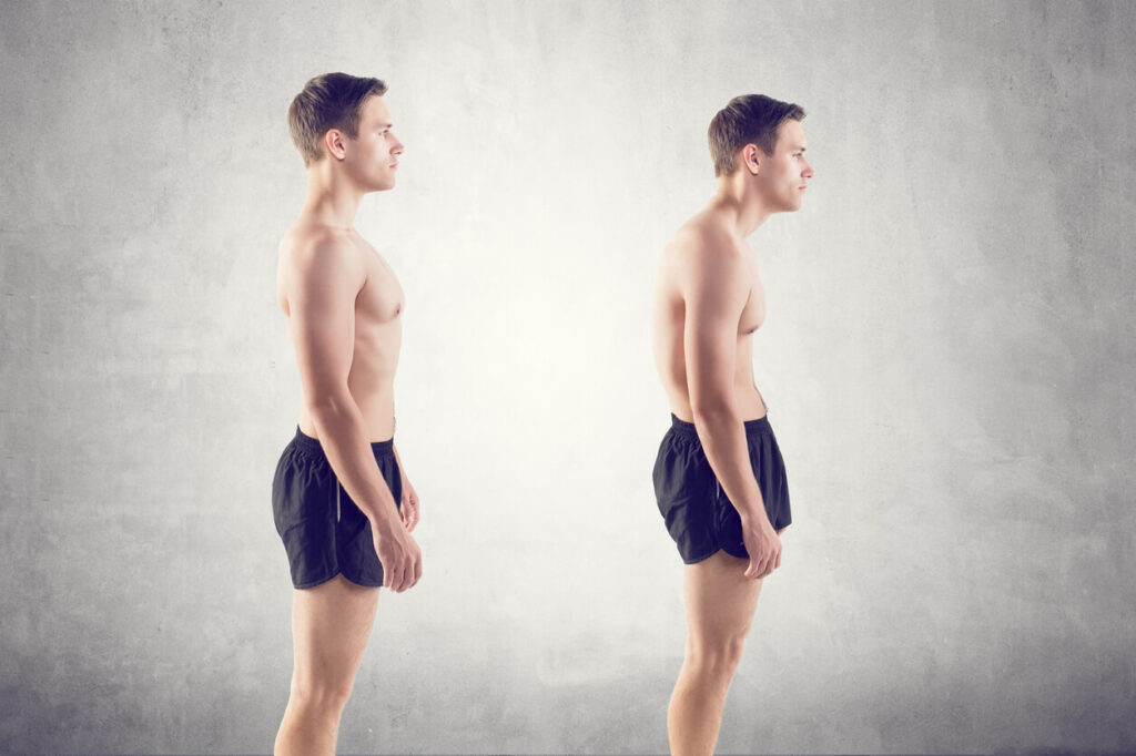 Two men in black shorts stand side by side against a gray background. The man on the left demonstrates good posture, while the man on the right exhibits poor posture, slouching with rounded shoulders.